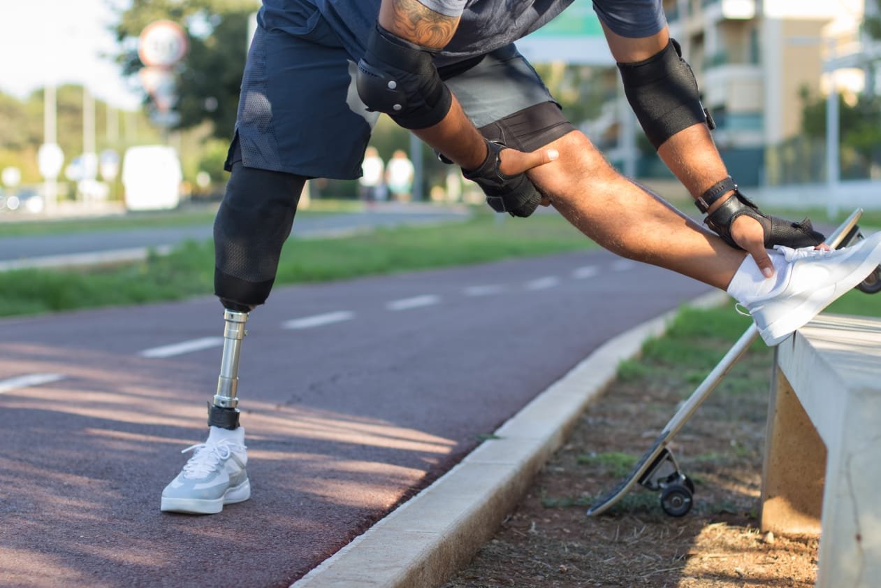 Artificial Limb Fabrication & Distribution